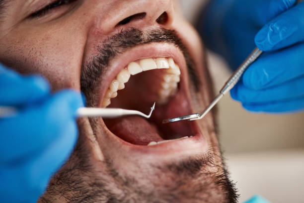 Best Teeth Whitening  in Merrifield, VA