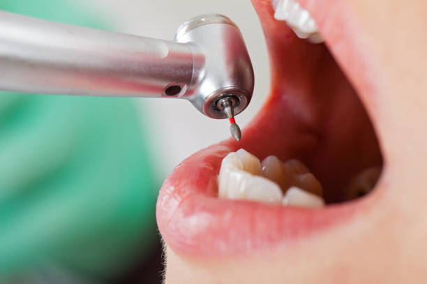 Best Tooth Infection Emergency Dentist  in Merrifield, VA